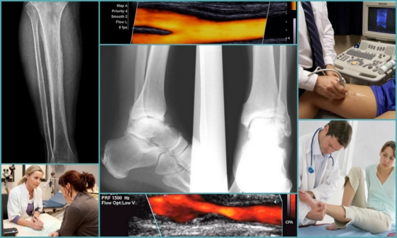 Caractéristiques de la mise en œuvre de la recanalisation du thrombus